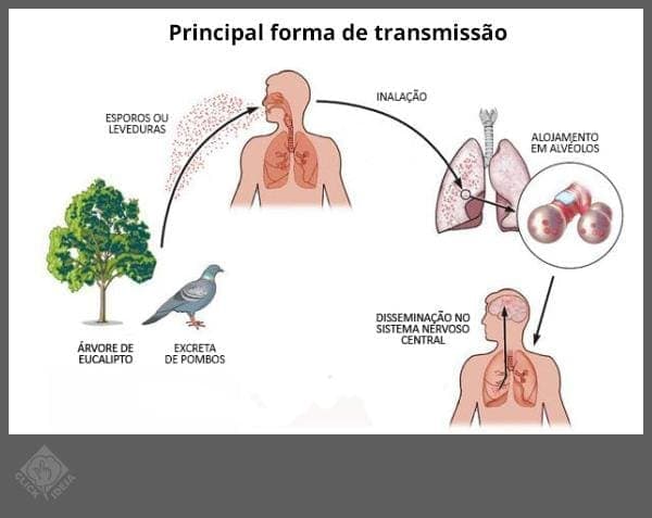 Você conhece a doença Criptococose, vulgo doença do pombo?