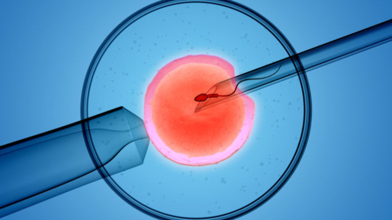 O que é a Fertilização In Vitro? foto