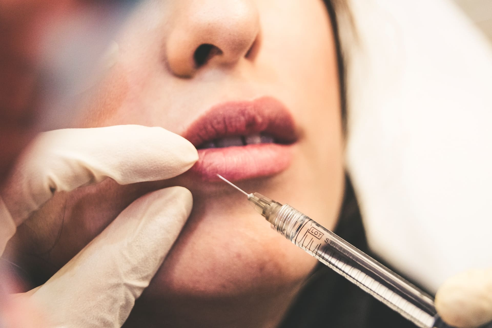 curso preenchimento labial gratuito curso preenchimento labial são paulo curso de preenchimento labial com caneta pressurizada curso preenchimento labial porto alegre curso de preenchimento com ácido hialurônico online curso preenchimento labial hotmart curso de preenchimento online curso de preenchimento avançado