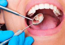 Semana Nacional de Prevenção do Câncer Bucal: CFO alerta sobre importância do diagnóstico precoce