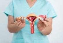 ENDOMETRIOSE AFETA MAIS DE 36 MIL MULHERES EM BASE NACIONAL E REFORÇA ALERTA NO MARÇO AMARELO